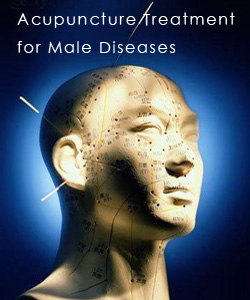Acupuncture Treatment for Male Diseases