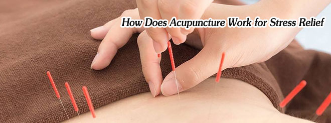 How Does Acupuncture Work for Stress Relief