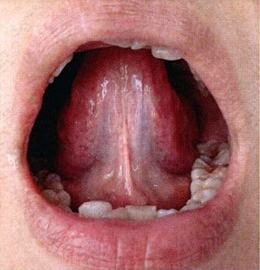 Structure and morphology of tongue