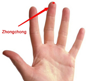 zhongchong (pc9)