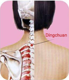 dingchuan (ex - b 1)