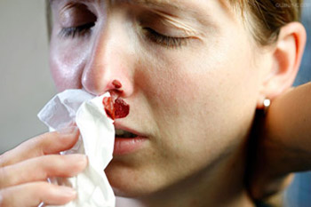 definition of nose bleeding in tcm