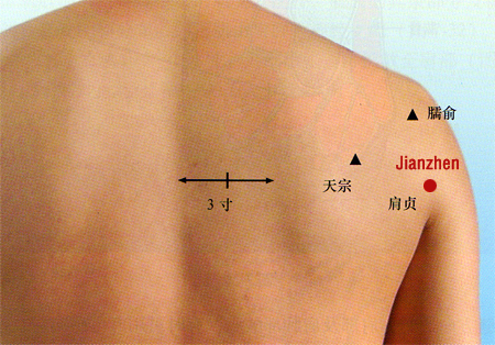 acupuncture single point jianzhen