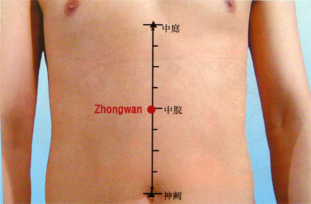 acupuncture single point zhongwan