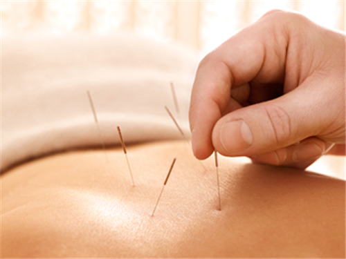 acupuncture shows promise in the management of sleep apnea