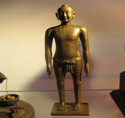 bronze statue for acupuncture