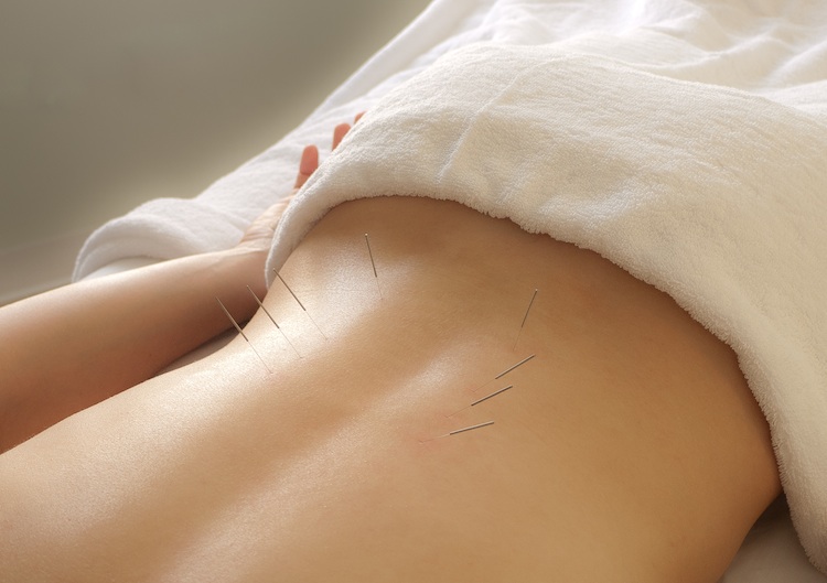 acupuncture, a glossary of traditional chinese medicine