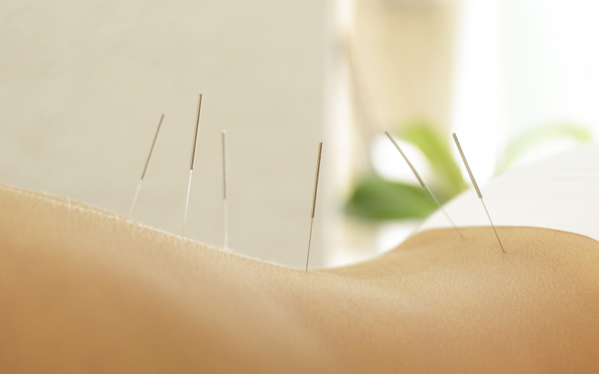 acupuncture and drugs found equally effective for depression