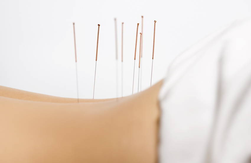 triple acupuncture safe and effective for low back pain