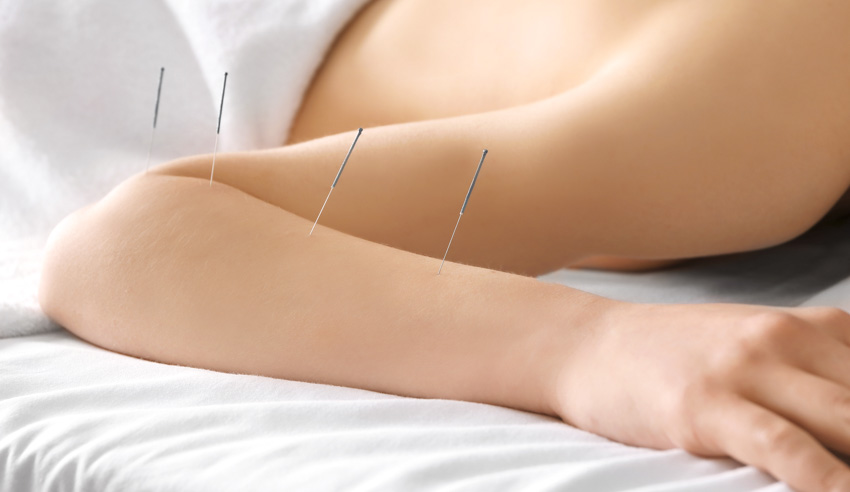 acupuncture effective for the treatment of essential tremor