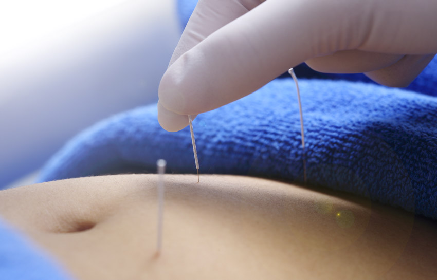 acupuncture increases clinical effective rate of pcos