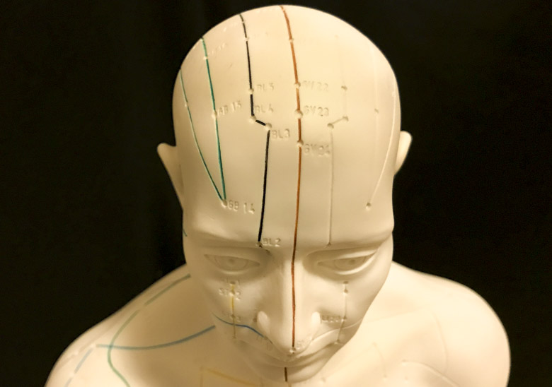 acupuncture benefits stroke patients