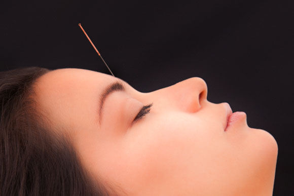 acupuncture and herbs alleviate hay fever (allergic rhinitis)