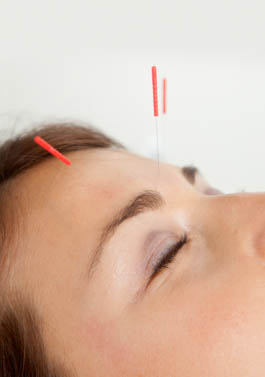 classic acupuncture points herbs used to treat insomnia