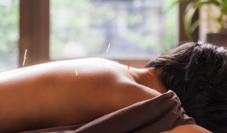 acupuncture benefits patients with parkinson disease