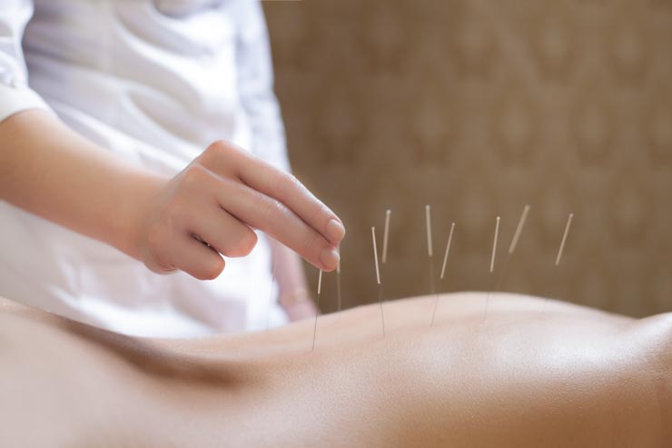 acupuncture plus herbs outperform drug therapy for ibs