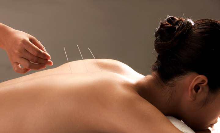 acupuncture successfully alleviates depression