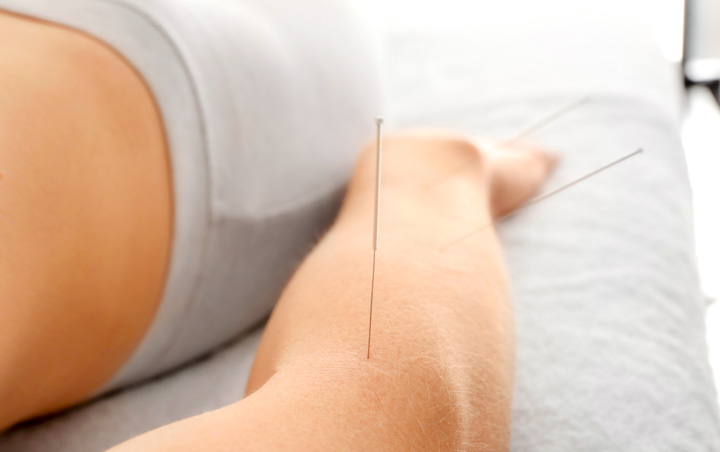 acupuncture, an effective treatment modality for pain and depression