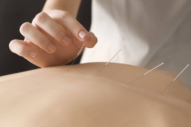 the effects of acupuncture on patients with post stroke depression