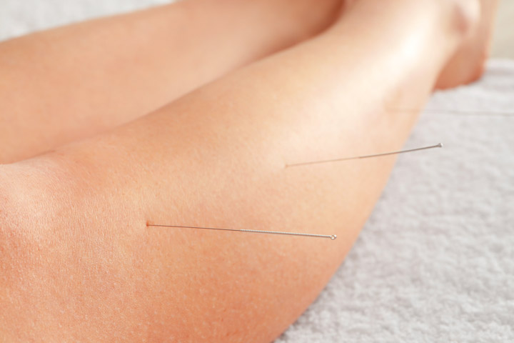 acupuncture used to soothe chronic cholecystitis